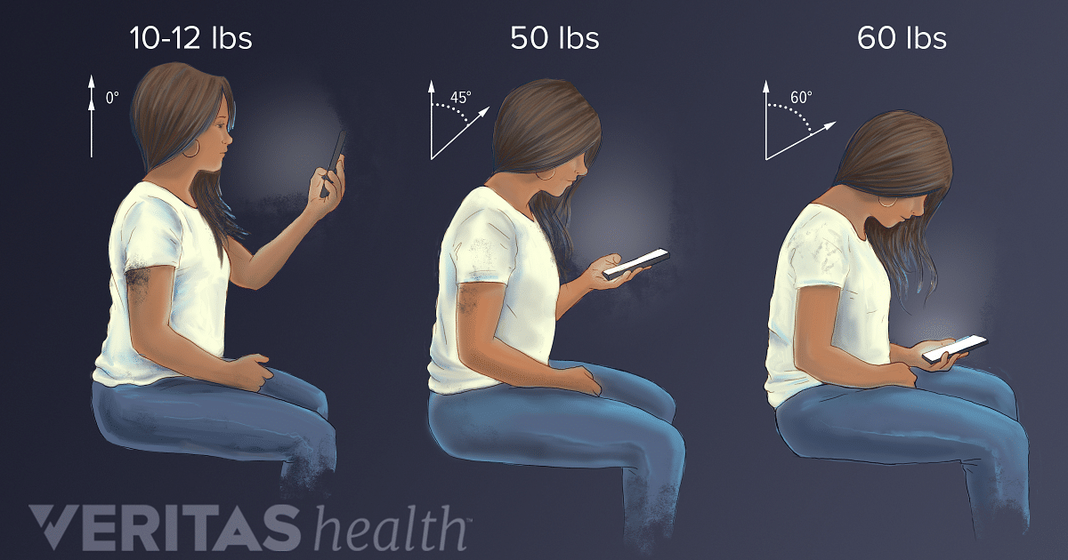 correct-posture-cell-phone